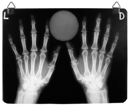 Stane Jagodič at the exhibition X-Ray Men / Invisible Worlds in Nessim Gallery in Budapest