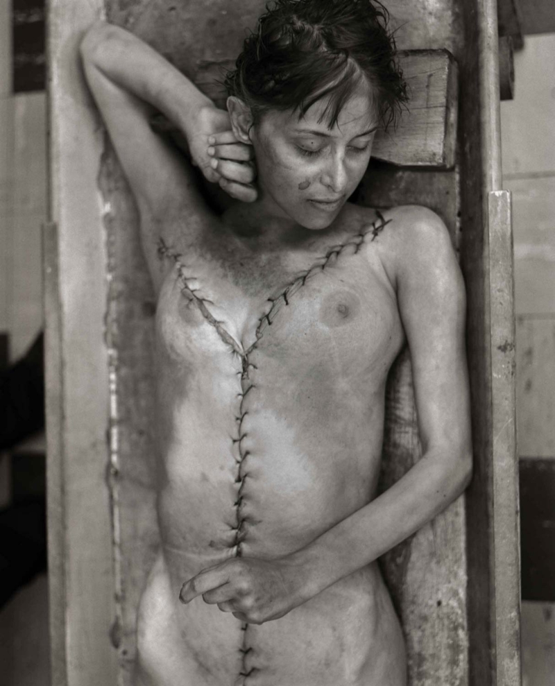 Jeffrey Silverthorne, from Morgue Work series, 1972-1991