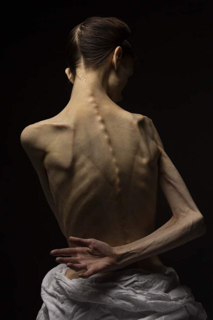 Goran Bertok / Hunger - Image 2